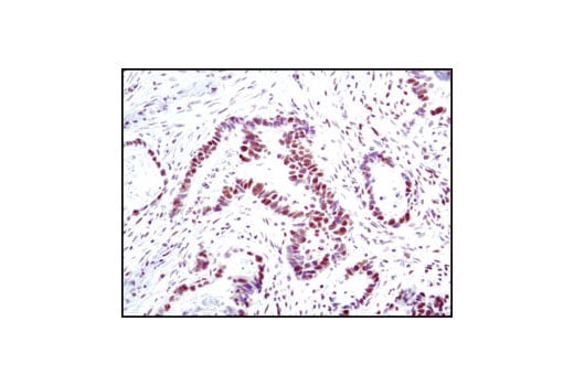 undefined Image 14: Double Strand Breaks (DSB) Repair Antibody Sampler Kit