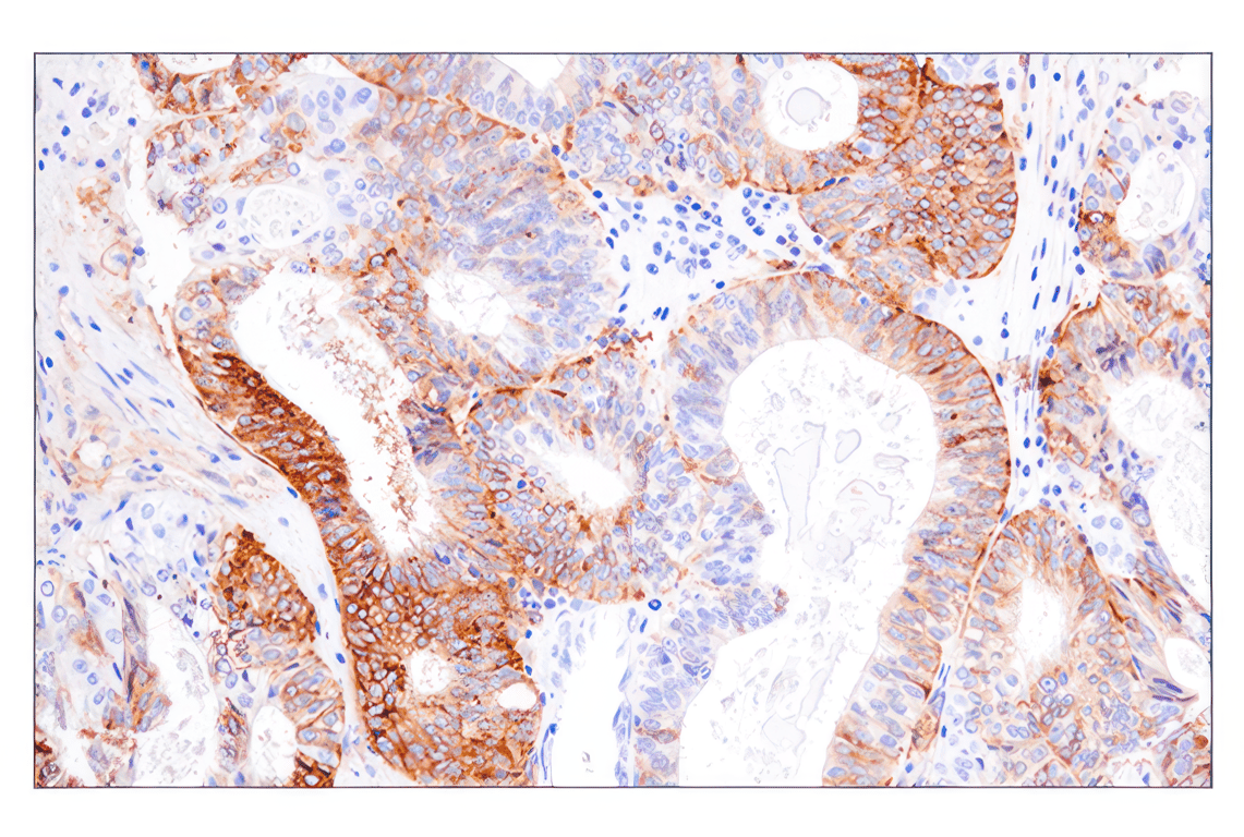 Immunohistochemistry Image 1: HLA-DRA (E9R2Q) Rabbit Monoclonal Antibody (BSA and Azide Free)