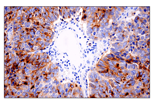 Immunohistochemistry Image 4: CD10/Neprilysin (E5P7S) Rabbit Monoclonal Antibody