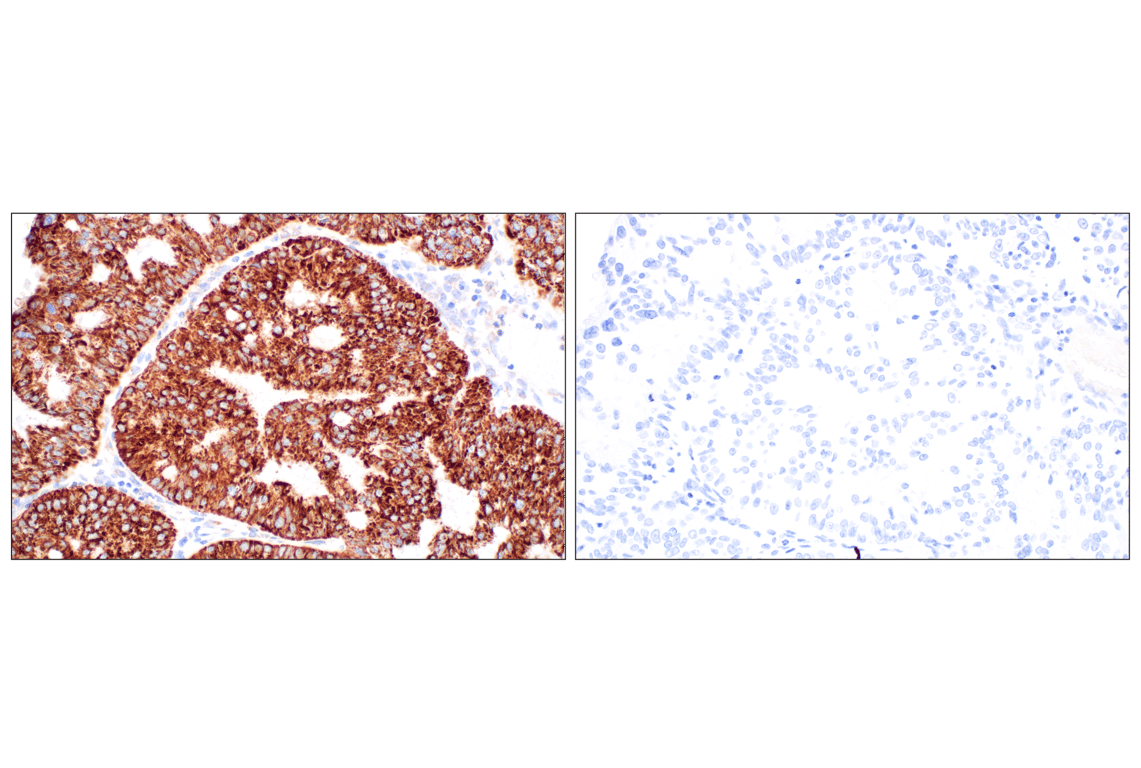 undefined Image 44: Organelle Localization IF Antibody Sampler Kit