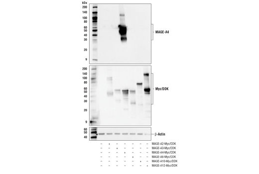 Western Blotting Image 2: MAGE-A4 (E7O1U) Rabbit Monoclonal Antibody