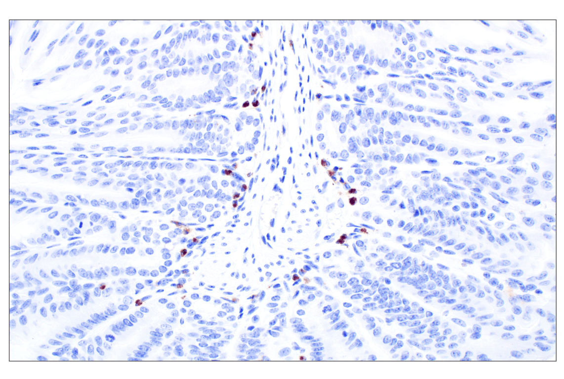 Immunohistochemistry Image 6: Eosinophil peroxidase (F3C2H) Rabbit Monoclonal Antibody