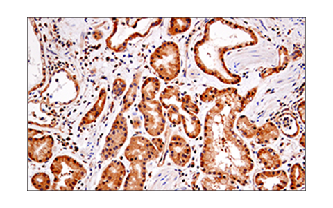 undefined Image 31: Apoptosis/Necroptosis Antibody Sampler Kit II