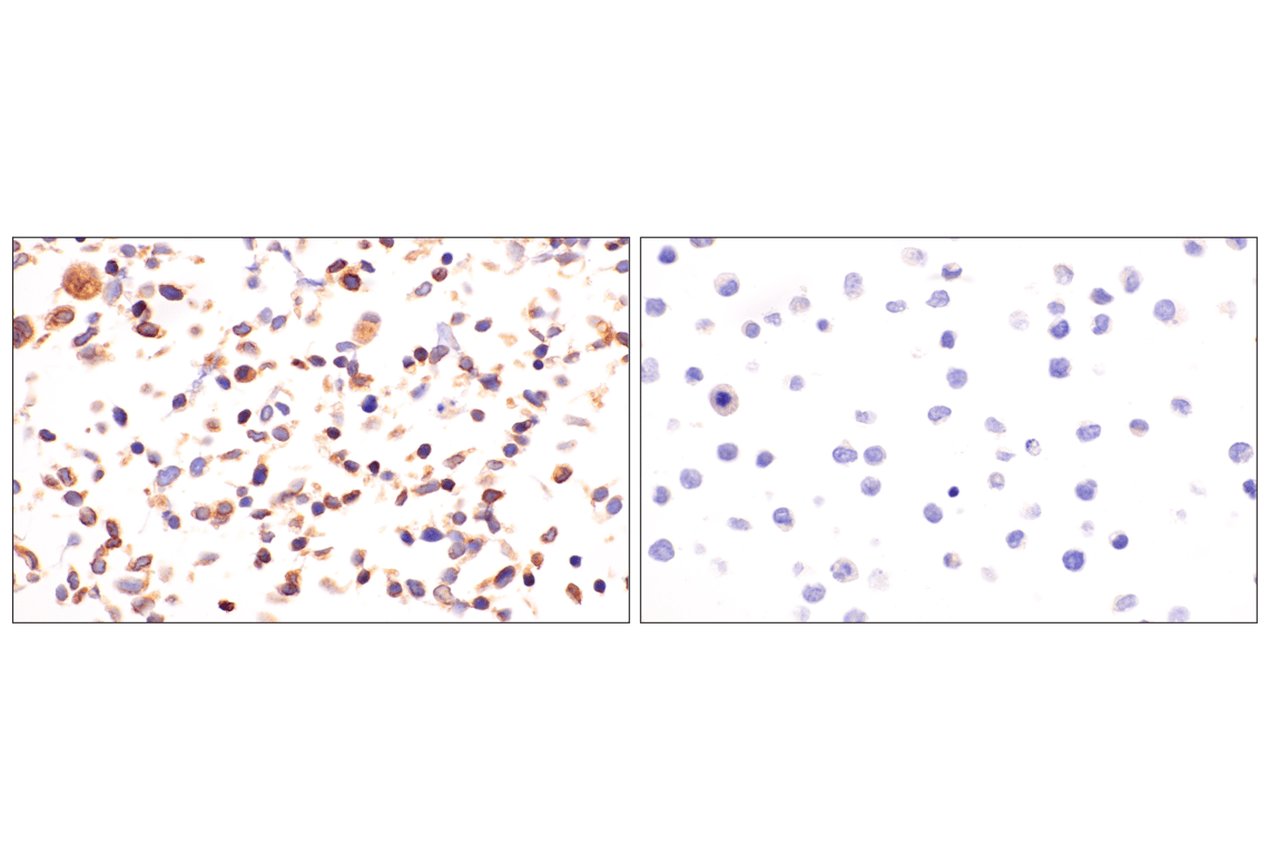 Immunohistochemistry Image 20: HLA-E (MEM-E/02) Mouse Monoclonal Antibody