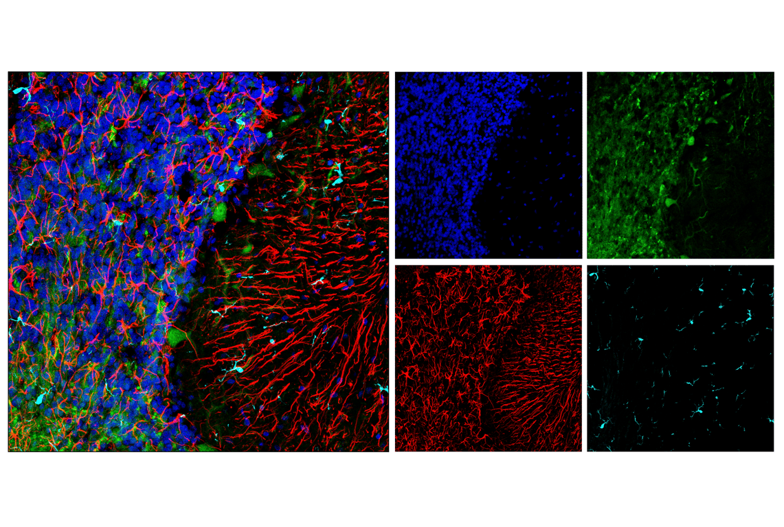 Immunofluorescence Image 1: GFAP (E8S7G) Mouse Monoclonal Antibody