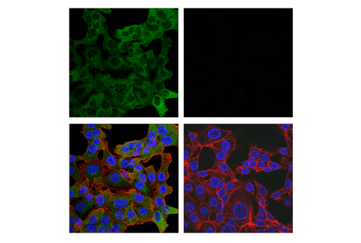 undefined Image 8: PhosphoPlus<sup>®</sup> TBK1/NAK (Ser172) Antibody Duet