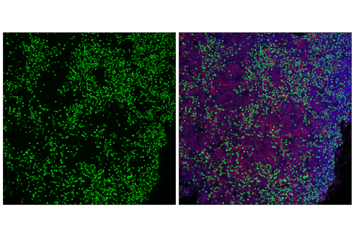 undefined Image 32: Rb Antibody Sampler Kit
