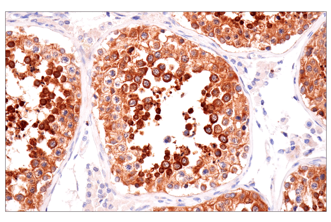 Immunohistochemistry Image 8: SPAK (F7T1K) Rabbit Monoclonal Antibody