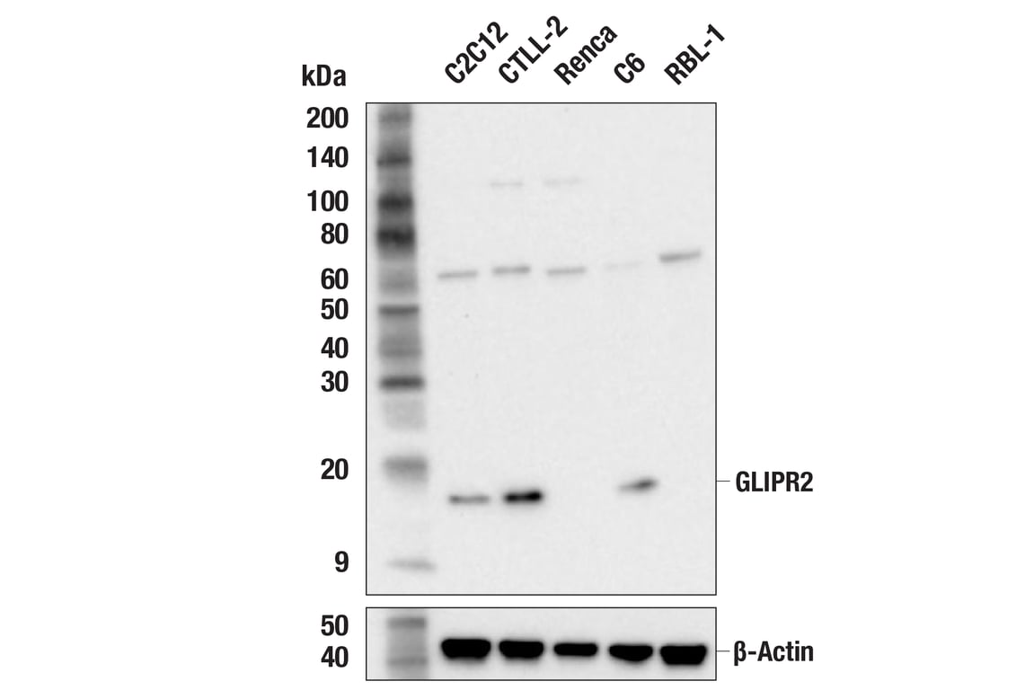 Western Blotting Image 2: GLIPR2 (F7H7V) Rabbit Monoclonal Antibody