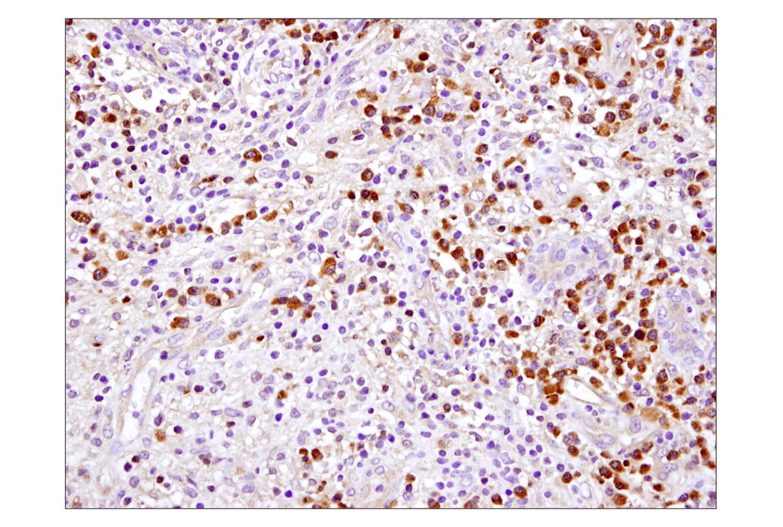 Immunohistochemistry Image 1: Caspase-3 (D3R6Y) Rabbit mAb (IHC Formulated)