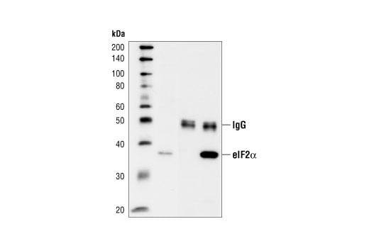 Immunoprecipitation Image 1: Phospho-eIF2 alpha (Ser51) (119A11) Rabbit Monoclonal Antibody