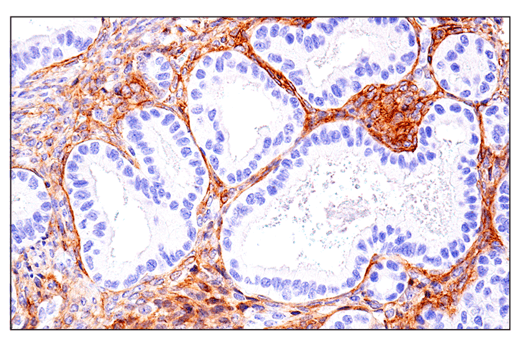Immunohistochemistry Image 4: CD248 (E9Z7O) Rabbit Monoclonal Antibody (BSA and Azide Free)