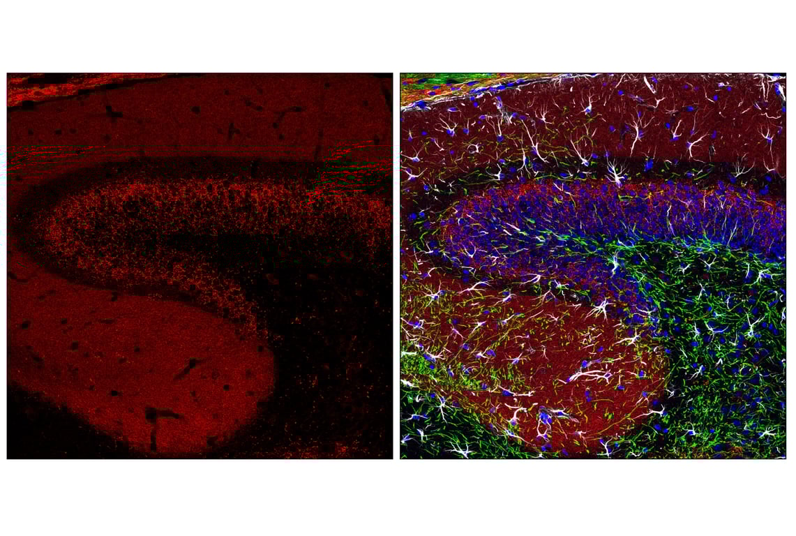 Immunofluorescence Image 1: VGLUT2 (E7P9K) Rabbit Monoclonal Antibody