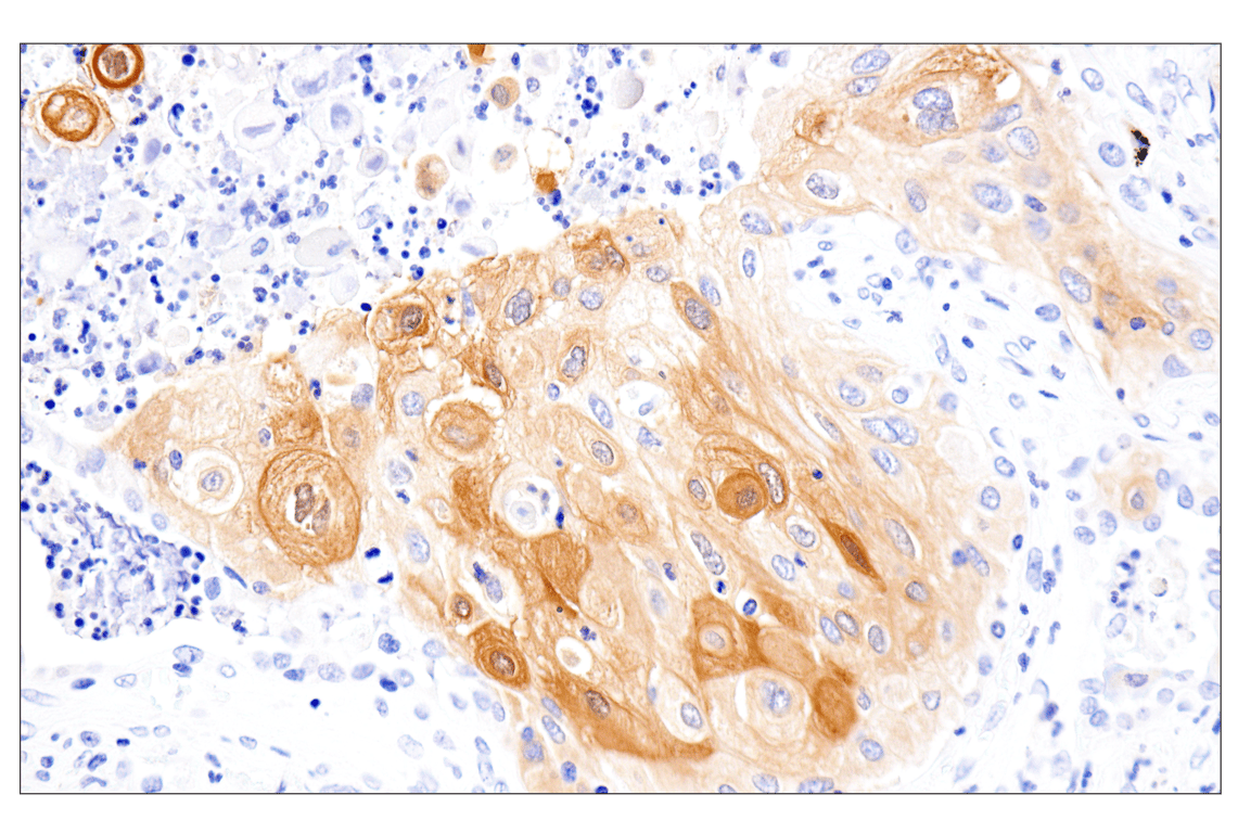Immunohistochemistry Image 1: APOBEC3A (UMN-13) Rabbit Monoclonal Antibody (BSA and Azide Free)