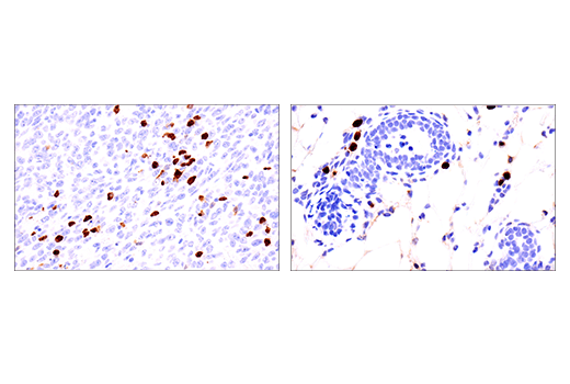 Immunohistochemistry Image 3: S100A8 (E4F8V) Rabbit Monoclonal Antibody (BSA and Azide Free)