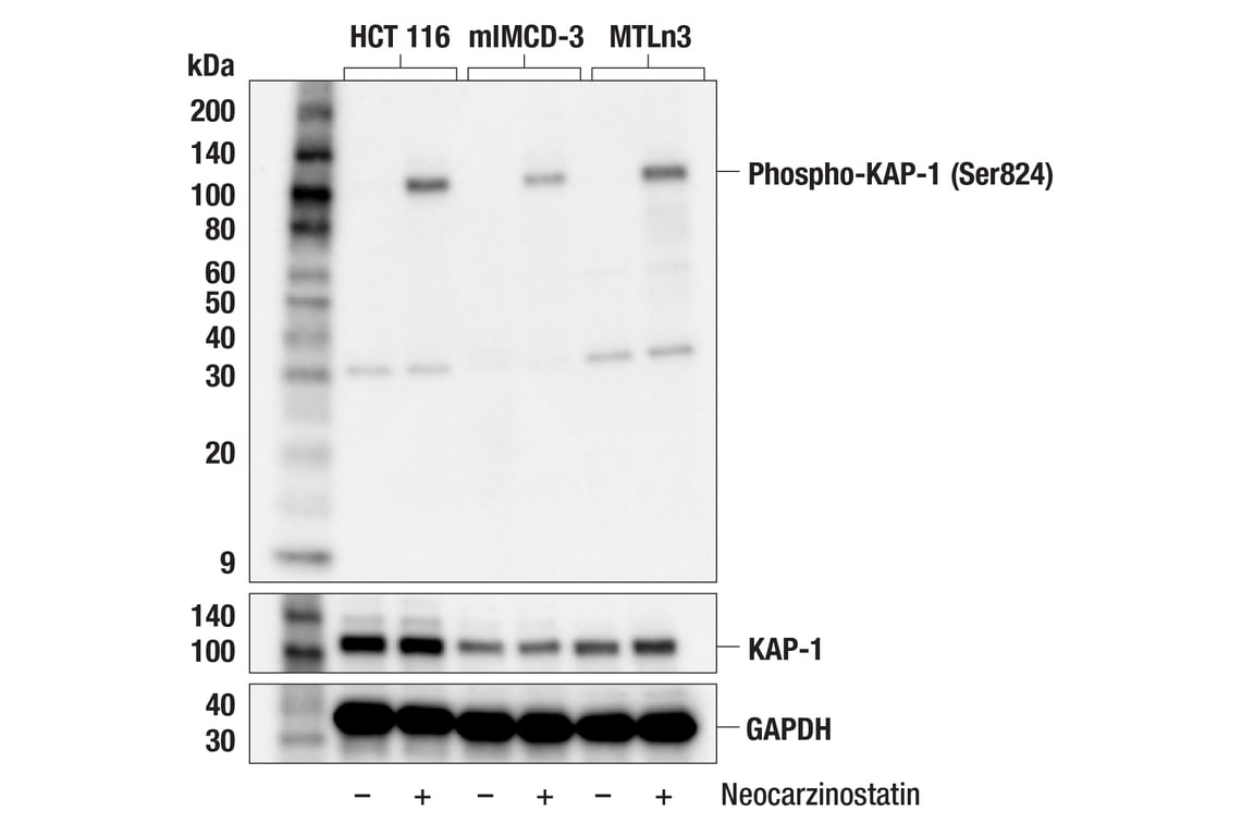 Western Blotting Image 2: Phospho-KAP-1 (Ser824) Antibody