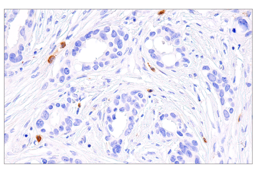 Immunohistochemistry Image 4: PAI-1 (E3I5H) Rabbit Monoclonal Antibody
