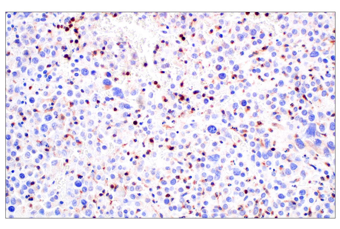 Immunohistochemistry Image 7: NPC1 (E7S4N) Rabbit Monoclonal Antibody