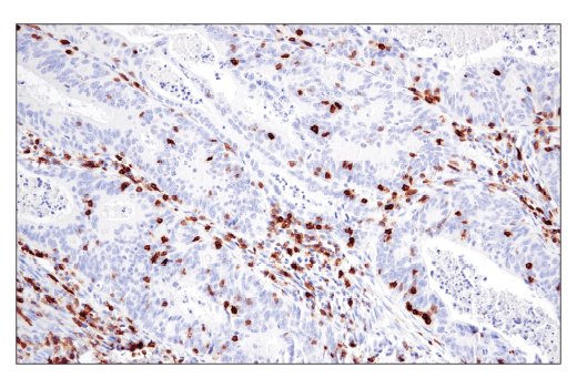 Immunohistochemistry Image 3: CD6 (E9Y7Y) Rabbit Monoclonal Antibody (BSA and Azide Free)
