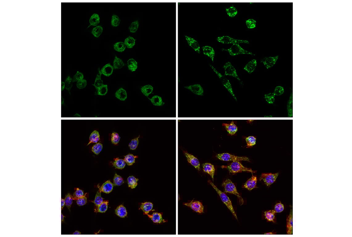 Immunofluorescence Image 1: G3bp1 (E8N8F) Rabbit Monoclonal Antibody