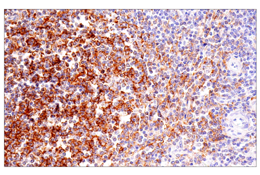 Immunohistochemistry Image 2: CD21/CR2 (2G9) Mouse Monoclonal Antibody