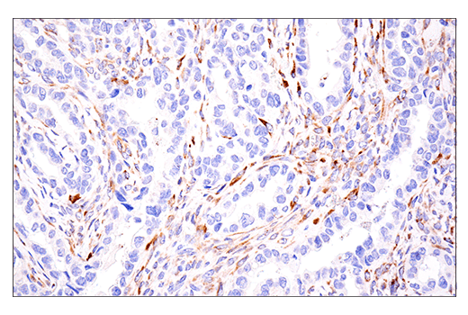 Immunohistochemistry Image 4: LOXL2 (E3P7Y) Rabbit Monoclonal Antibody (BSA and Azide Free)