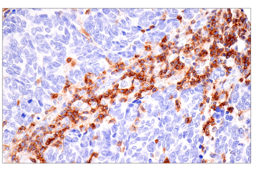 Immunohistochemistry Image 4: SLAMF6/CD352 (E3H1E) Rabbit Monoclonal Antibody