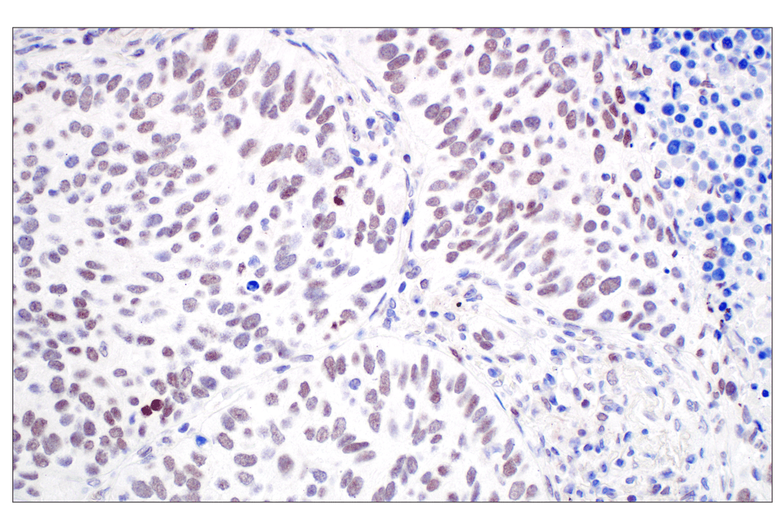 Immunohistochemistry Image 2: MDM2 (F7W7X) Rabbit Monoclonal Antibody (BSA and Azide Free)