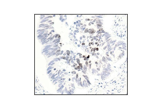 Immunohistochemistry Image 1: Phospho-Histone H3 (Thr3) Antibody