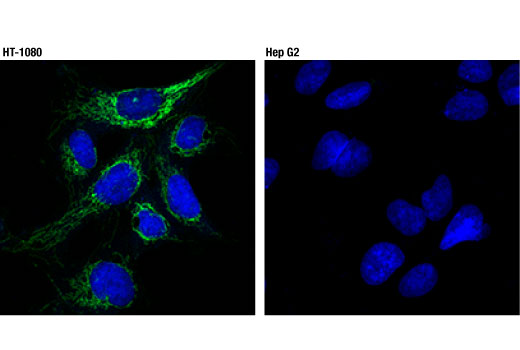 Immunofluorescence Image 1: TSPO (D1N7Z) Rabbit Monoclonal Antibody