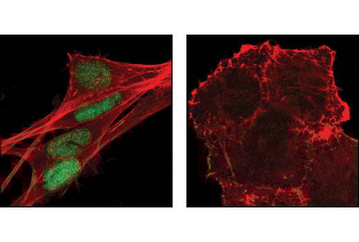 undefined Image 35: Epithelial-Mesenchymal Transition (EMT) Antibody Sampler Kit