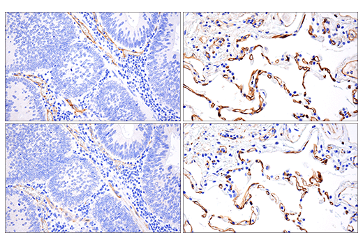 Immunohistochemistry Image 1: VE-Cadherin (E6N7A) Rabbit Monoclonal Antibody (BSA and Azide Free)