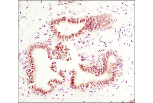 Immunohistochemistry Image 1: Phospho-Stat5 (Tyr694) (C71E5) Rabbit Monoclonal Antibody (BSA and Azide Free)