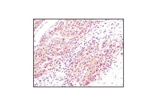 Immunohistochemistry Image 1: Akt (pan) (C67E7) Rabbit Monoclonal Antibody (BSA and Azide Free)