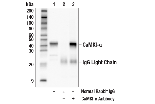 Immunoprecipitation Image 1: CaMKI-alpha Antibody