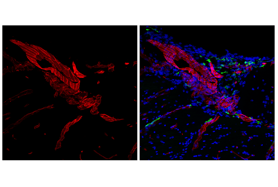 Immunofluorescence Image 3: CD31 (PECAM-1) (F2N3M) Rabbit Monoclonal Antibody (Alexa Fluor<sup>®</sup> 555 Conjugate)