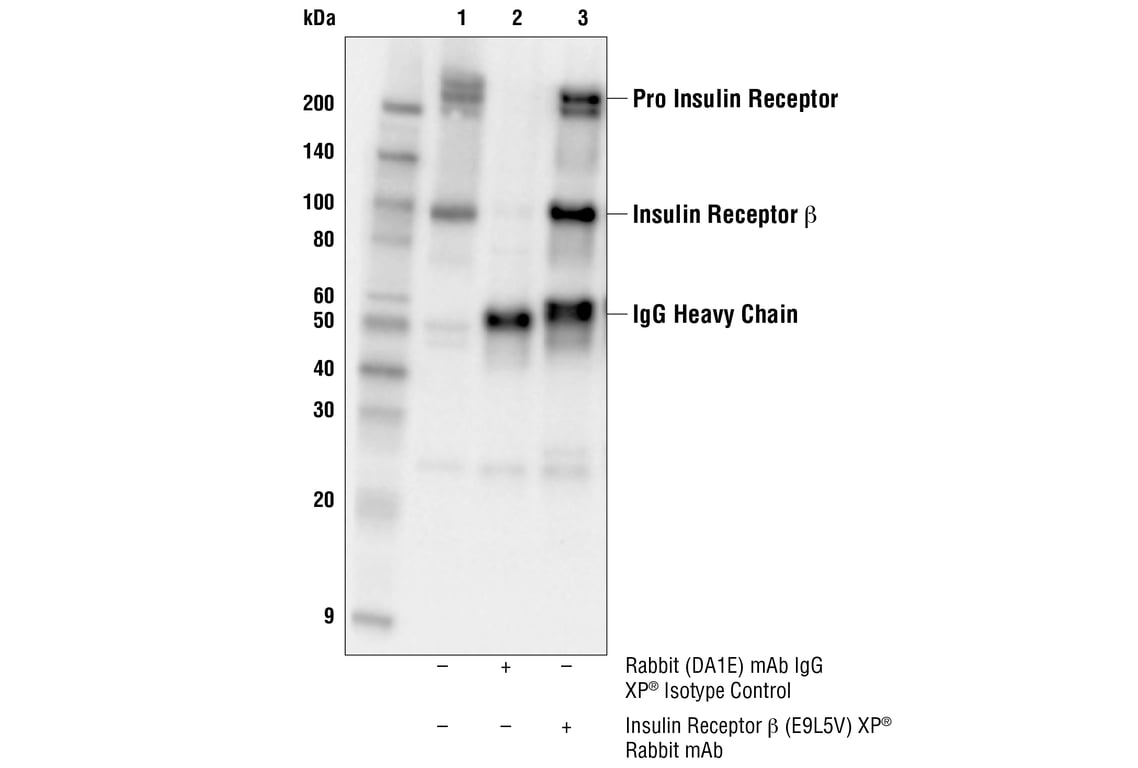 Immunoprecipitation Image 1: Insulin Receptor beta (E9L5V) Rabbit Monoclonal Antibody