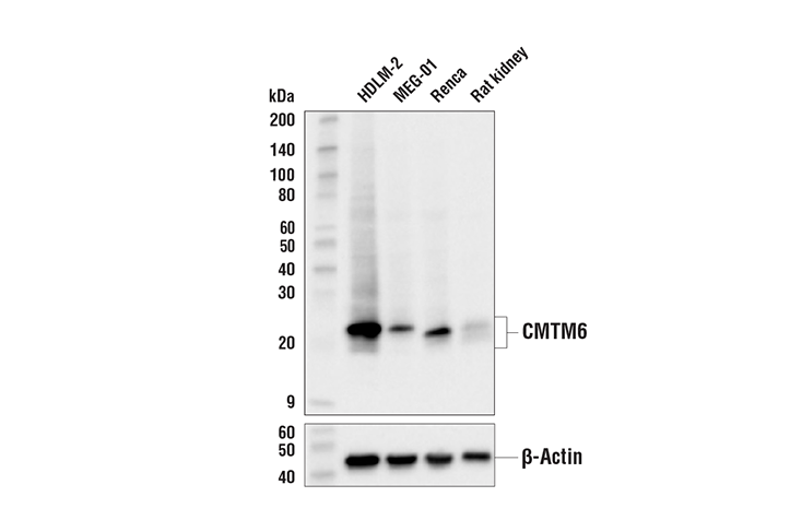Western Blotting Image 2: CMTM6 (E6A8T) Rabbit Monoclonal Antibody