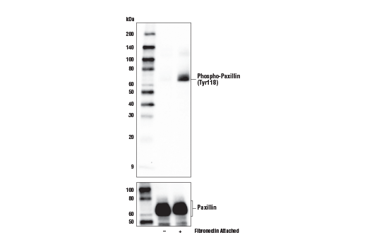 Western Blotting Image 1: Phospho-Paxillin (Tyr118) (E9U9F) Rabbit mAb