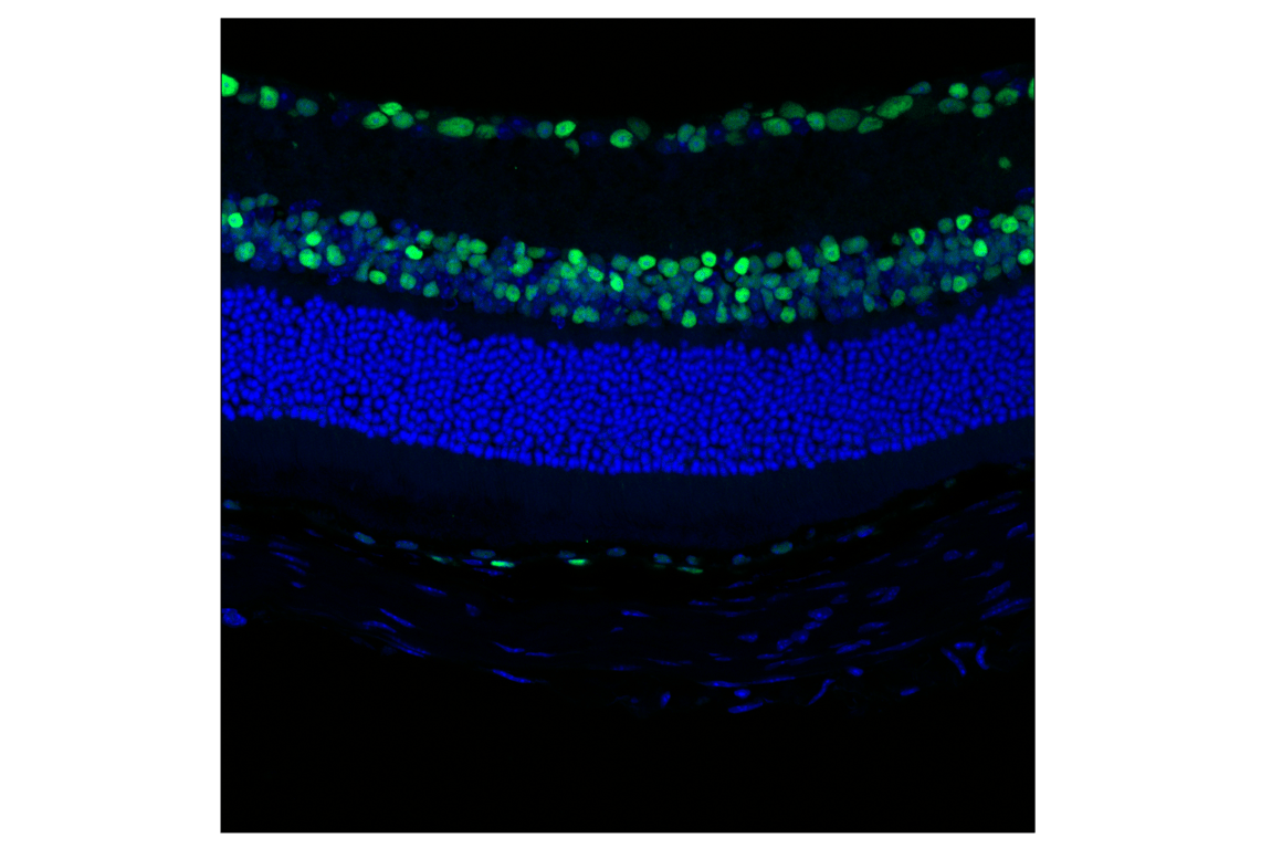 Immunofluorescence Image 2: SIX3 (F1I1S) Rabbit Monoclonal Antibody