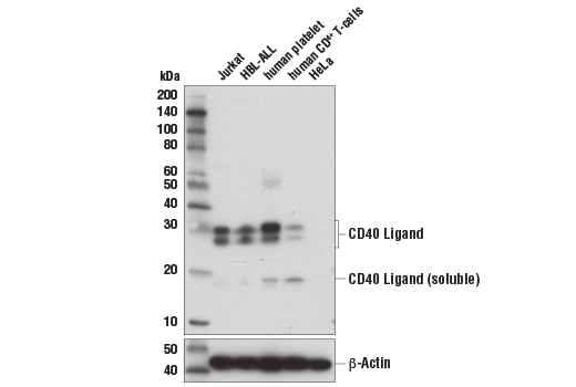 Western Blotting Image 2: CD40 Ligand (D5J9Y) Rabbit Monoclonal Antibody (BSA and Azide Free)