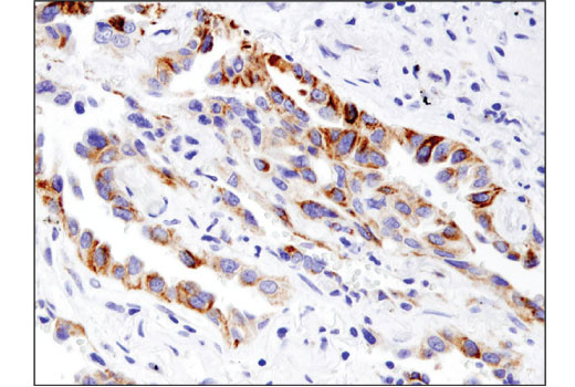 undefined Image 24: Mitophagy Antibody Sampler Kit