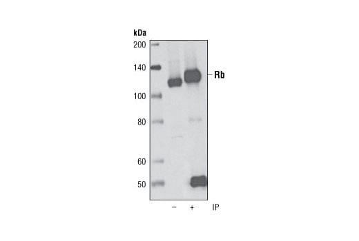Immunoprecipitation Image 1: Rb (D20) Rabbit Monoclonal Antibody