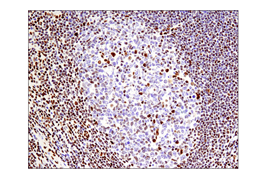 Immunohistochemistry Image 10: Phospho-ATF-2 (Thr71)/ATF-7 (Thr53) (E4A5G) Rabbit Monoclonal Antibody