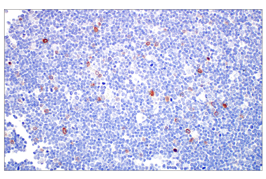 Immunohistochemistry Image 5: TRDC/TCR delta (E2E9T) Rabbit Monoclonal Antibody (BSA and Azide Free)