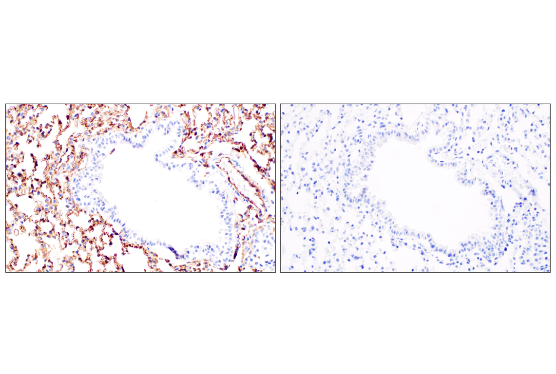 Immunohistochemistry Image 5: beta2-microglobulin (F4S6H) Rabbit Monoclonal Antibody