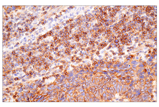 Immunohistochemistry Image 5: CD99 (PCB1) Mouse mAb