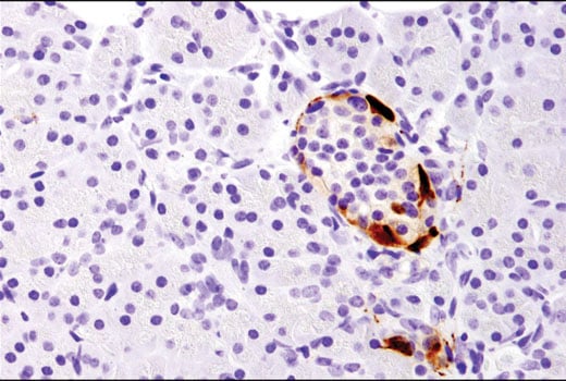 Immunohistochemistry Image 3: CART (D6M2M) Rabbit Monoclonal Antibody