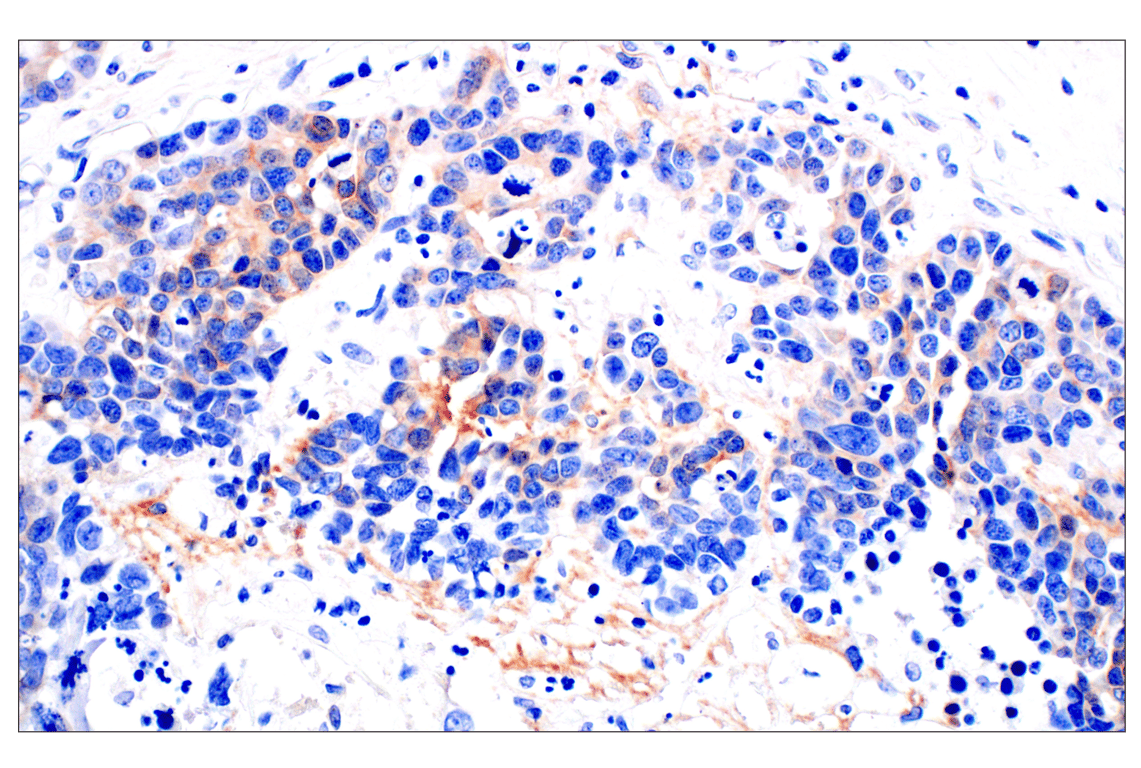 Immunohistochemistry Image 2: Neuropilin-2 (E5Q2G) Rabbit Monoclonal Antibody (BSA and Azide Free)