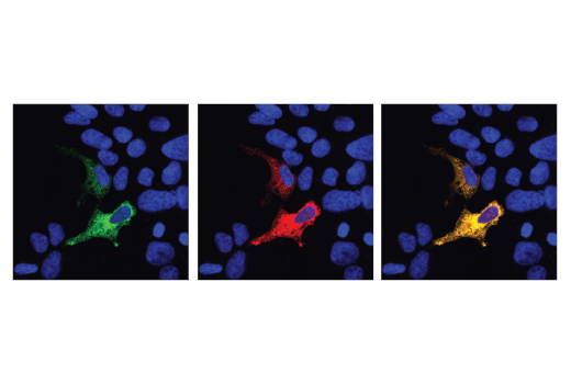 Immunofluorescence Image 1: Cas9 (<i>S. aureus</i>) (E4G3U) Rabbit Monoclonal Antibody
